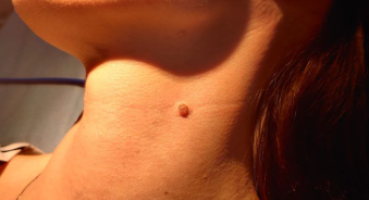 Mendukung Regenerasi Sel untuk Kulit Bersih dan Terawat